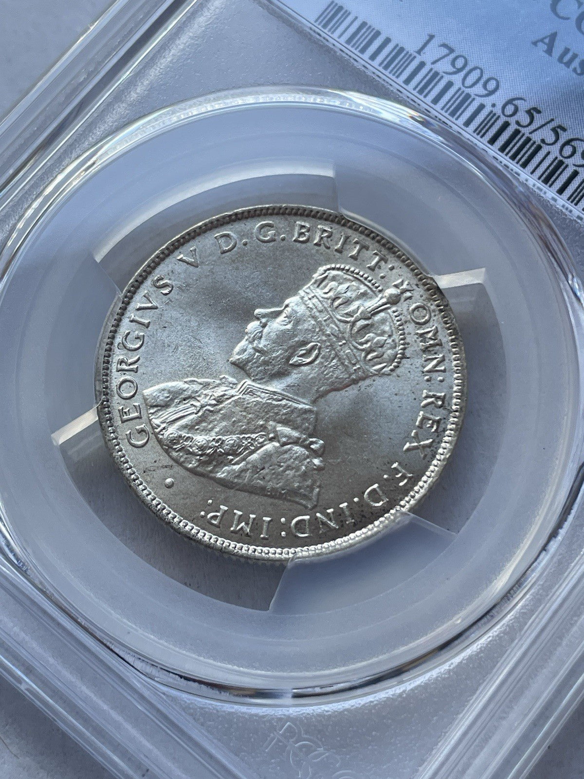7551261